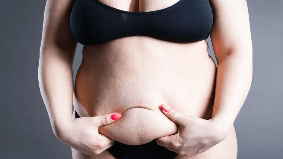 Pubertät, Schwangerschaft und Lipödem: Warum Frauen besonders betroffen sind