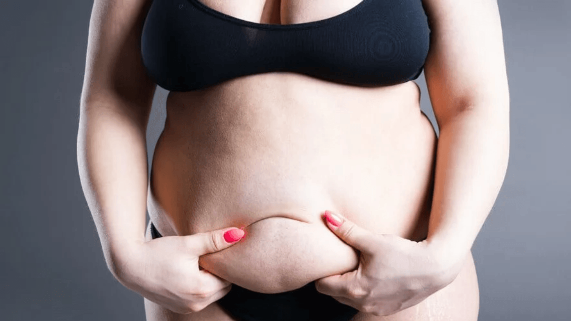 Pubertät, Schwangerschaft und Lipödem: Warum Frauen besonders betroffen sind