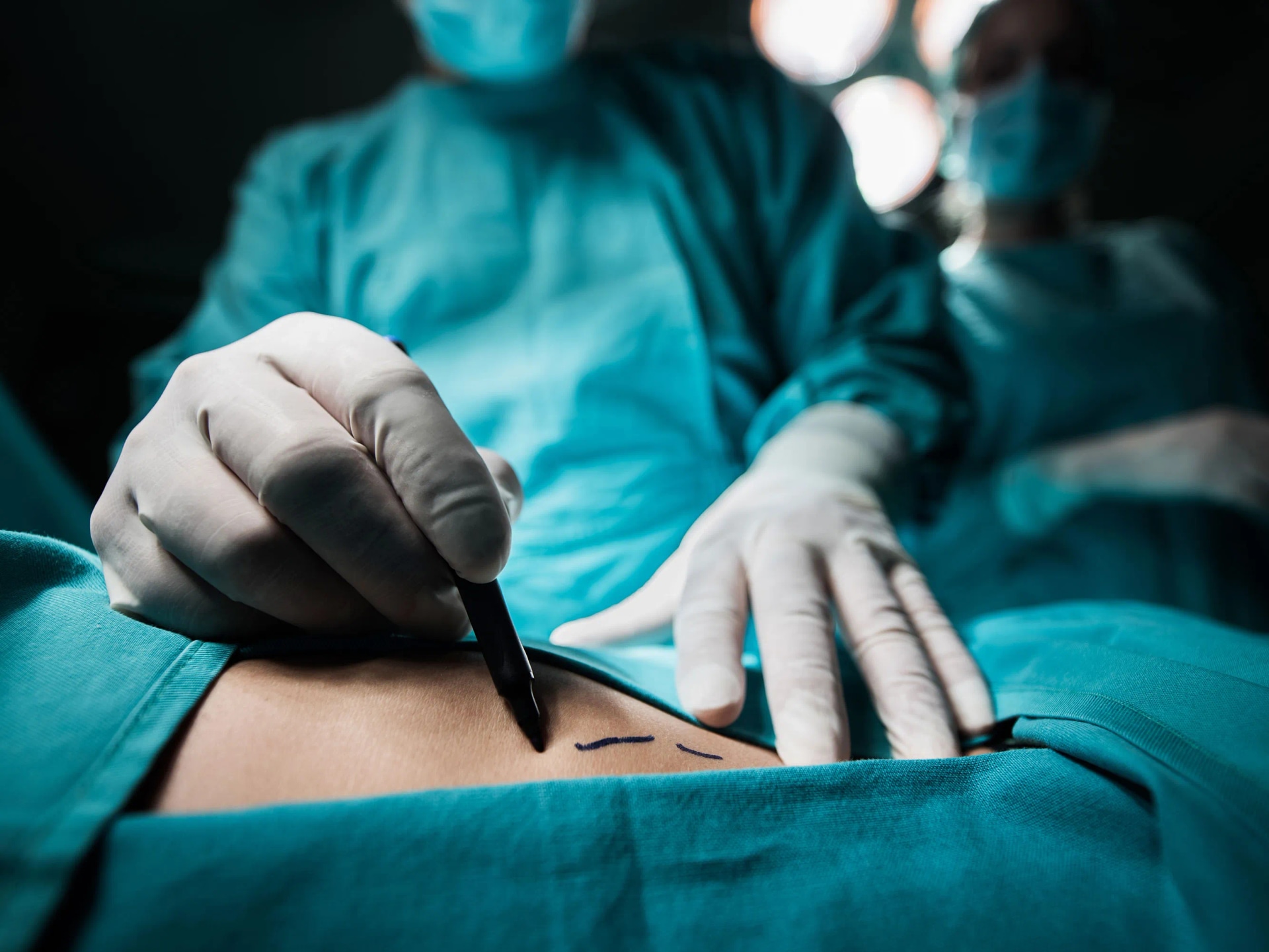 Tubuläre Brust und ihre Behandlung: Plastische Chirurgie in Bochum