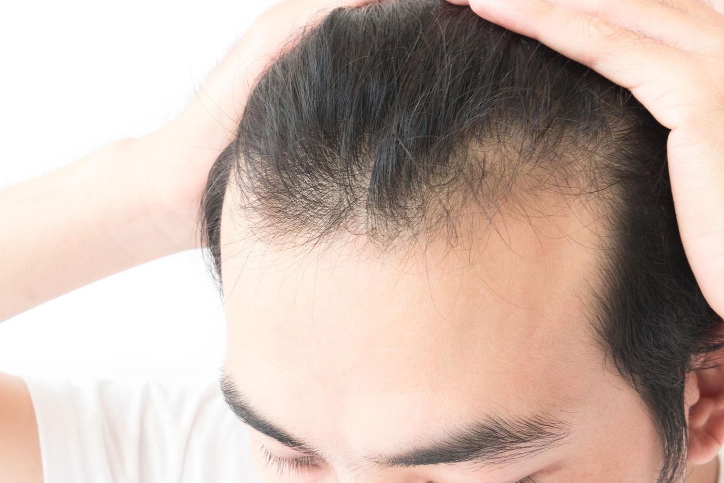 Haarige Fakten: Wie viele Haare hat ein Mensch im Durchschnitt?